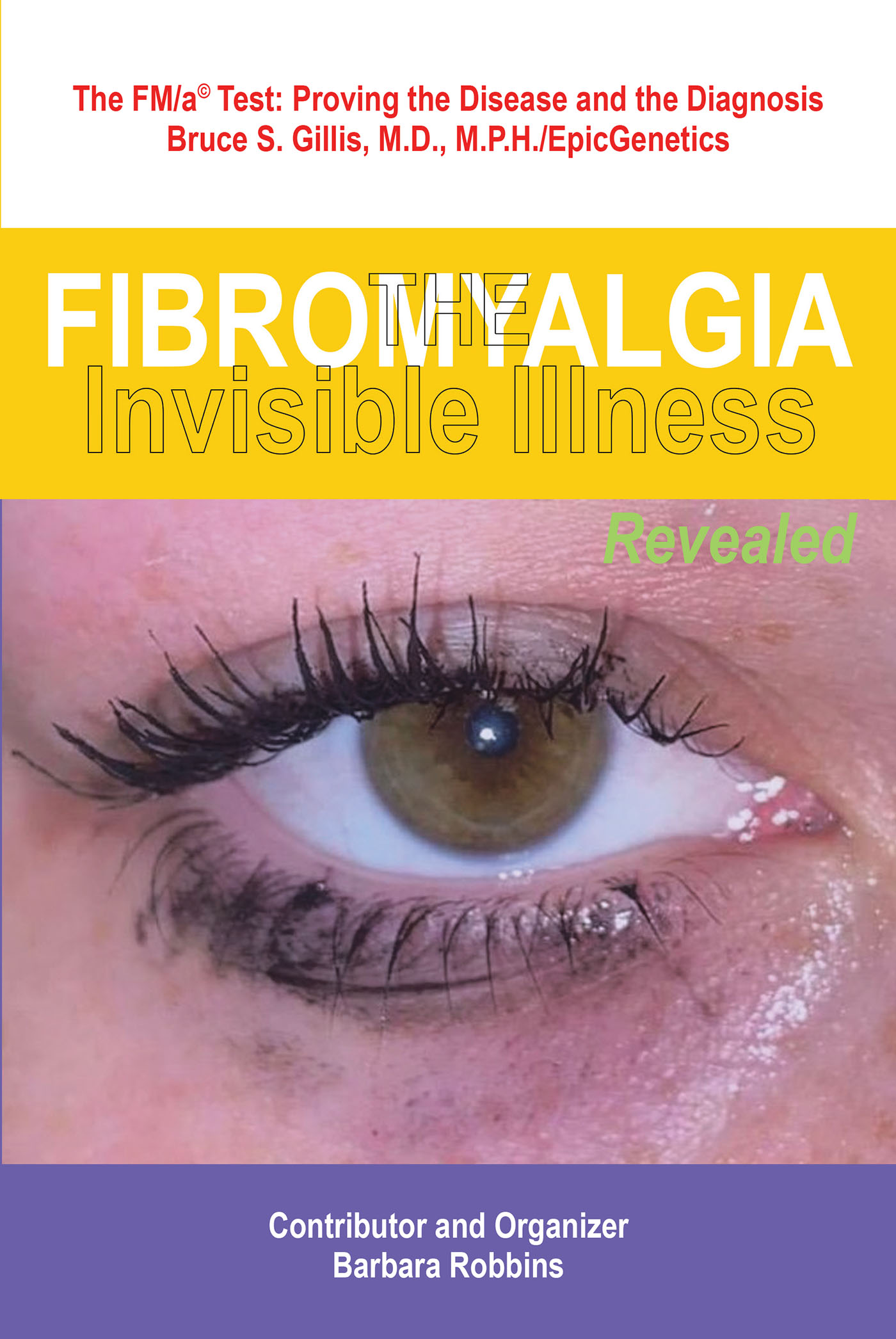 Fibromyalgia Cover Image